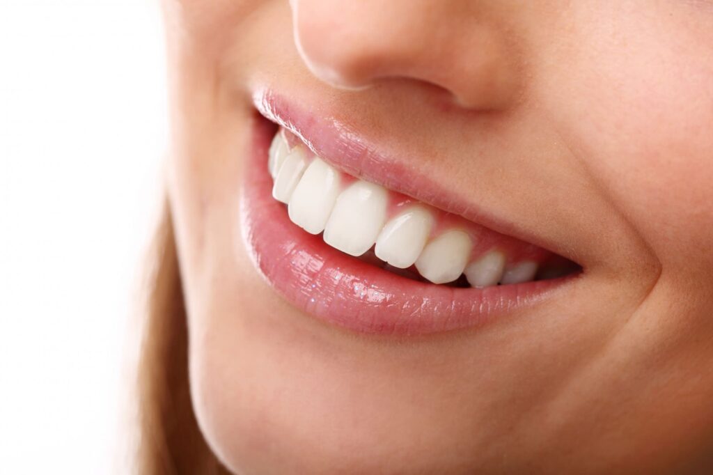 implantes-dentales