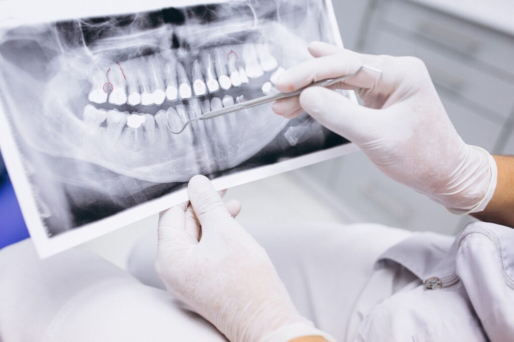 cirugia-dental
